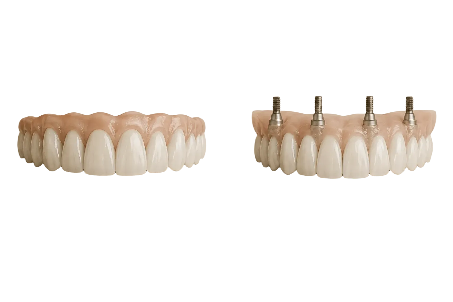 3D illustration comparing traditional dentures and implant-supported dentures side by side