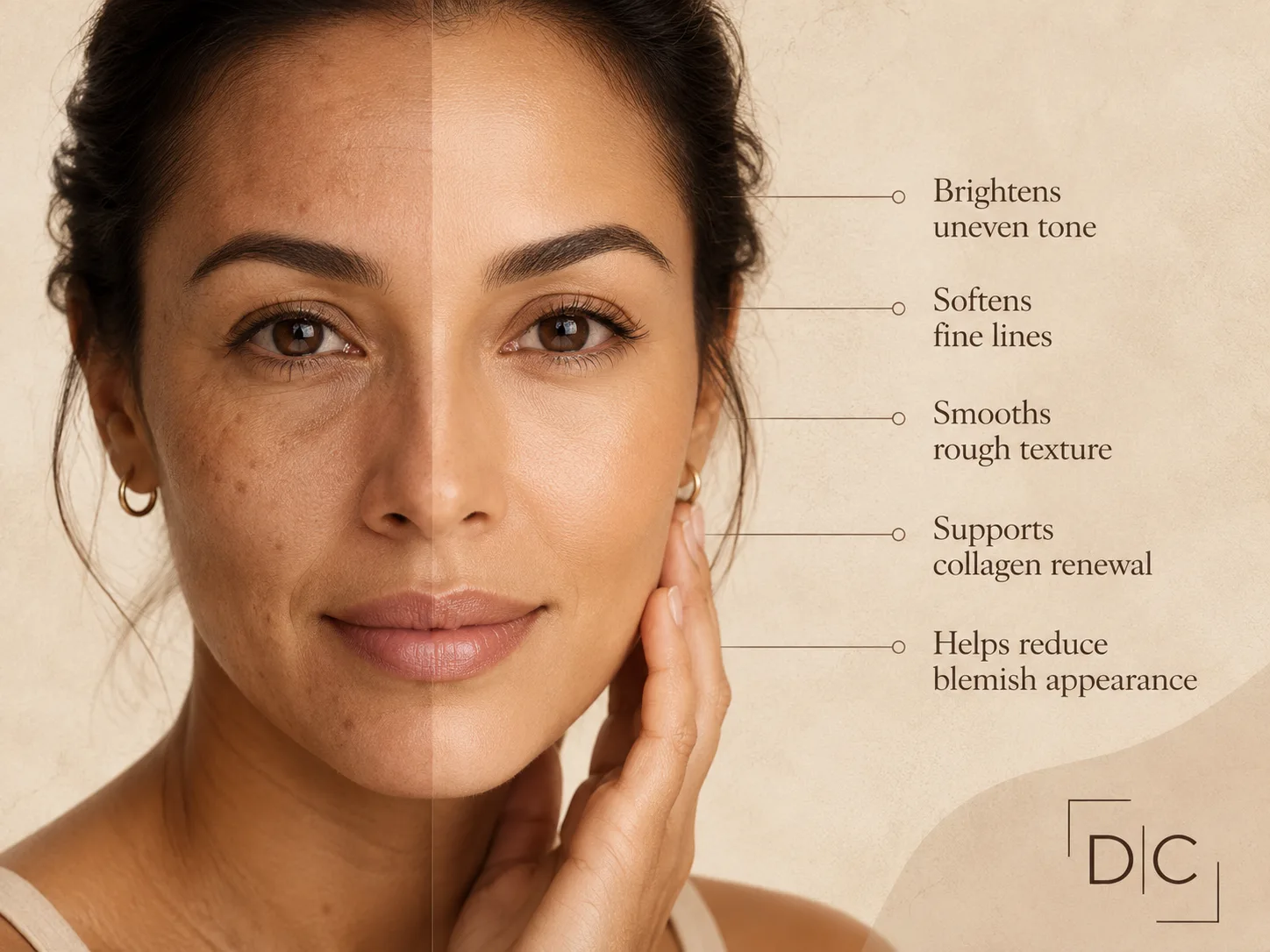 Microneedling benefits diagram showing skin brightening, fine line reduction, texture smoothing, collagen renewal, and blemish improvement