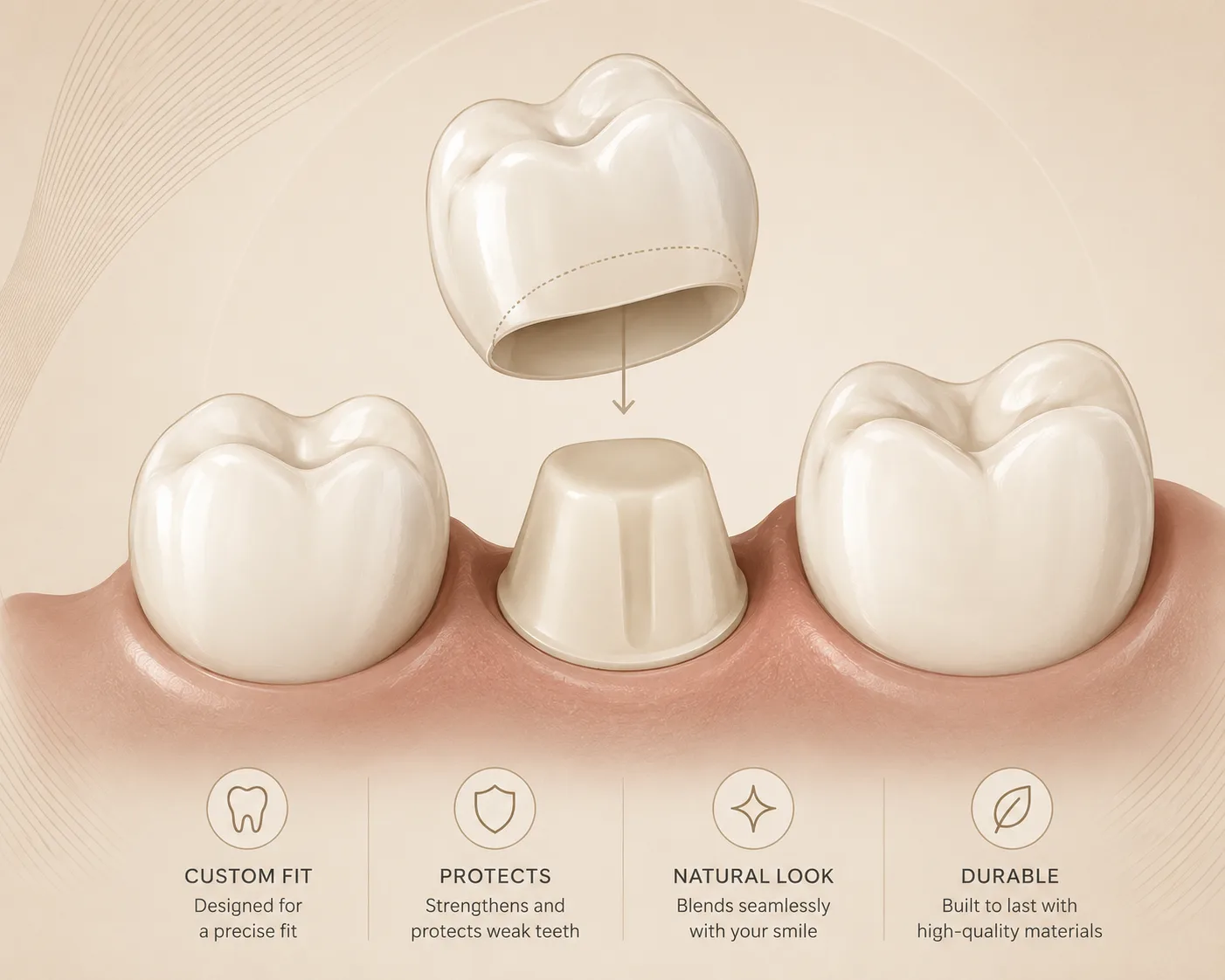 Infographic showing custom fit, protection, natural look, and durability benefits of dental crowns